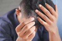 Waarom steeds meer mannen nu ook hun hoofdhuid verzorgen